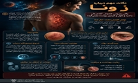 نکات مهم بیماری زونا